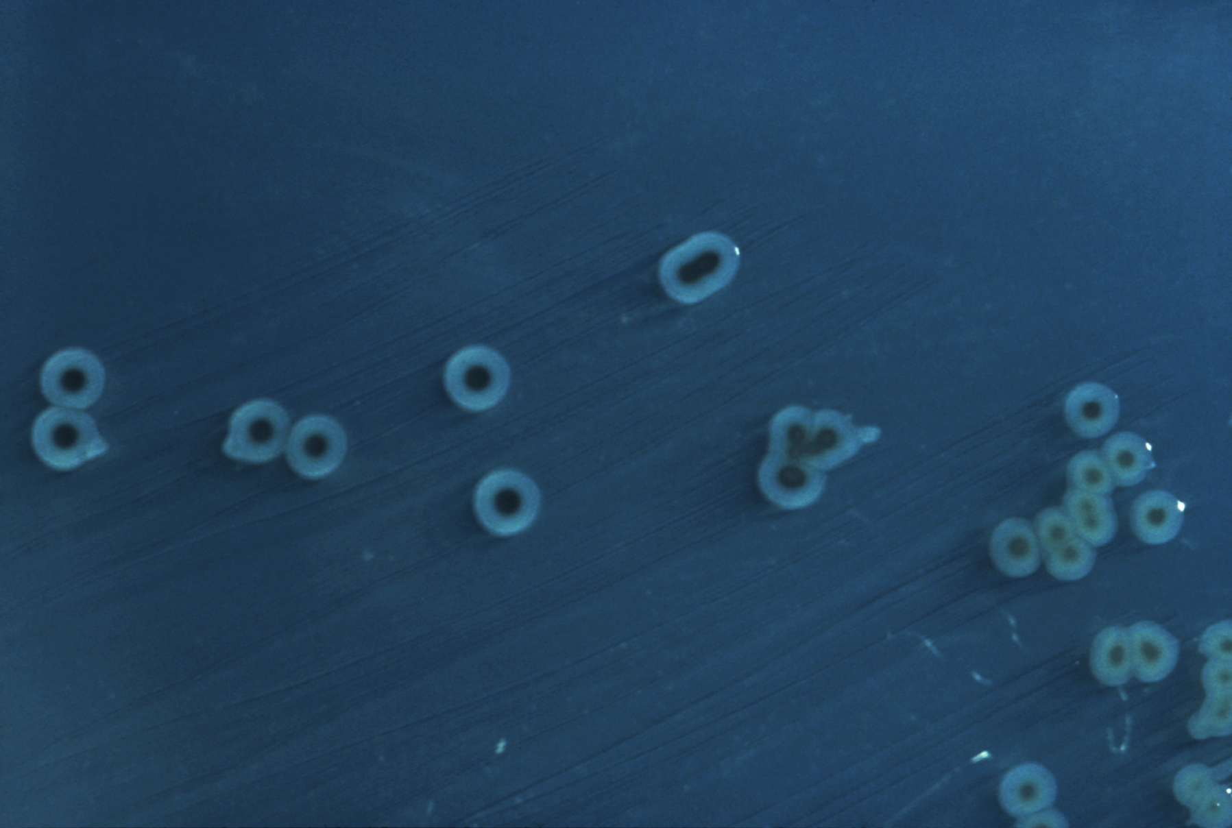 Salmonella enterica al microscopio elettronico